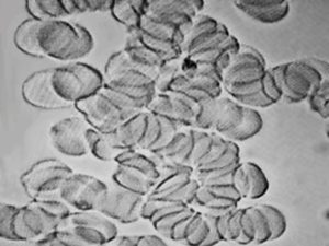 Aggregation - Copy
