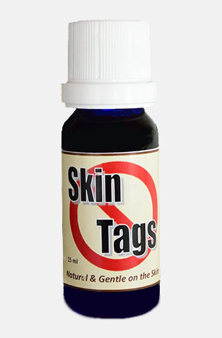 skin-tagsg